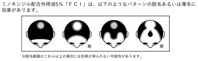 ミノキシジル配合外用液「FCI」のご紹介